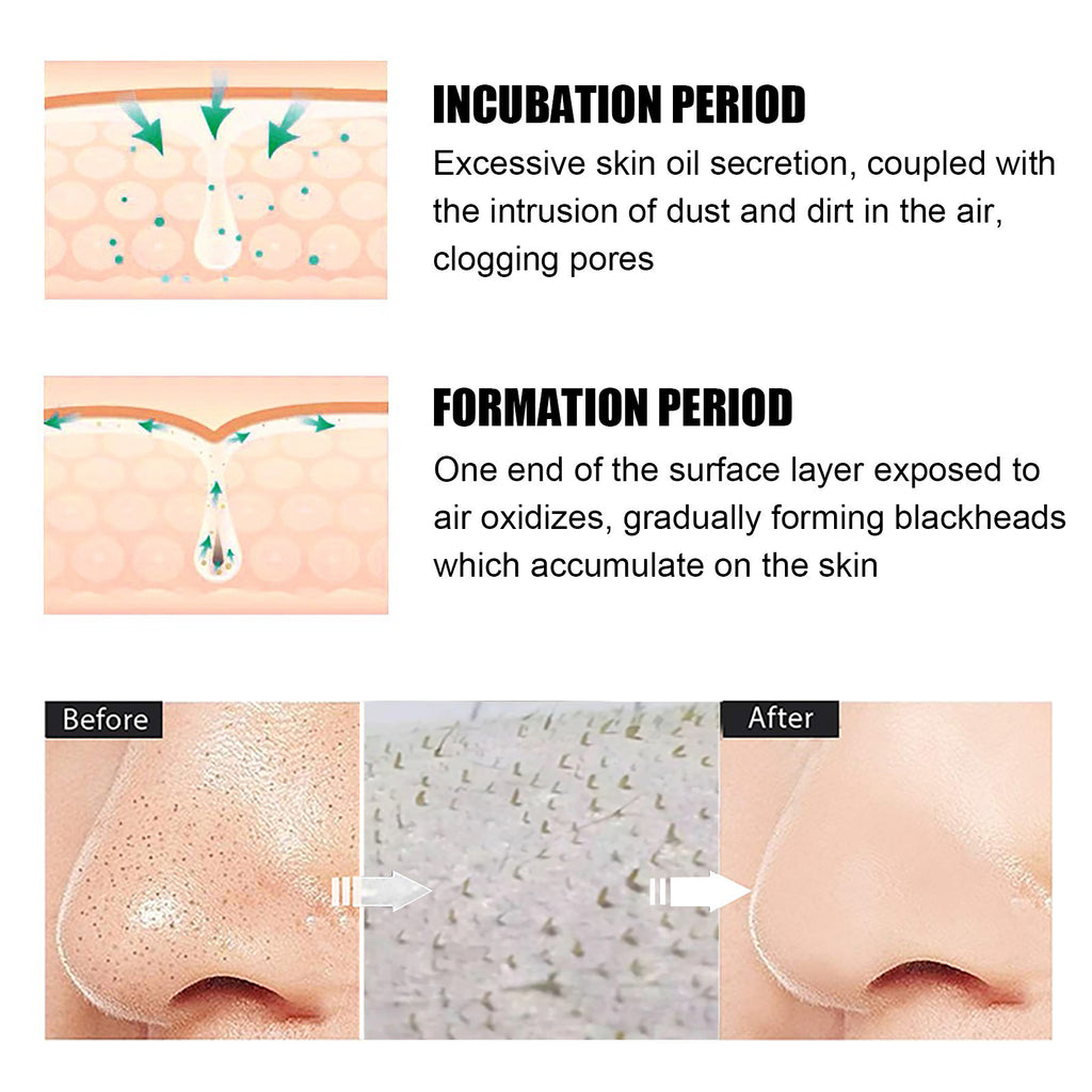 Blackhead Remover Peel-Off Mask