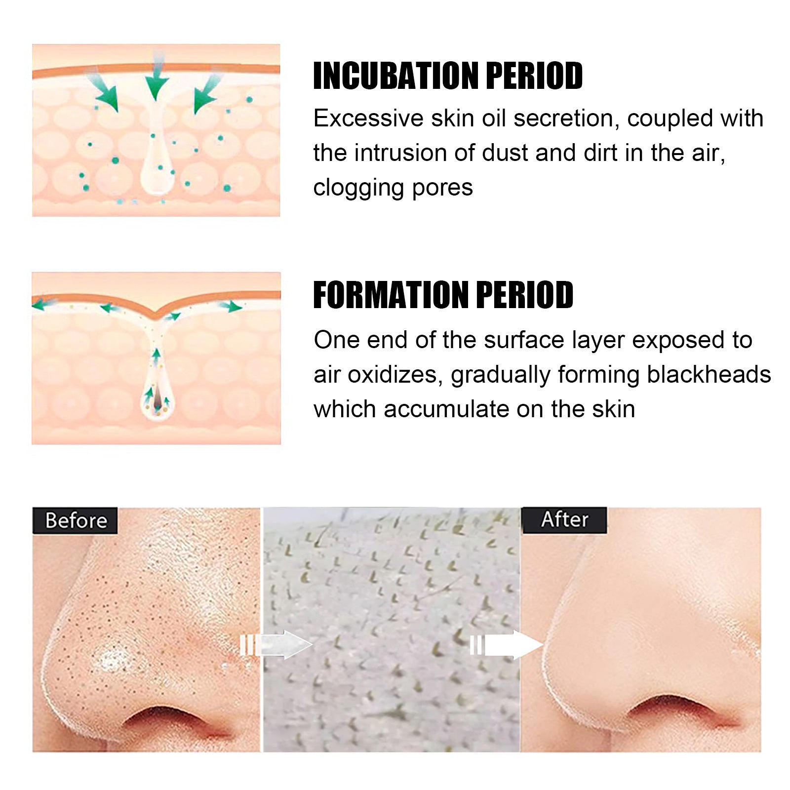 Blackhead Remover Peel-Off Mask