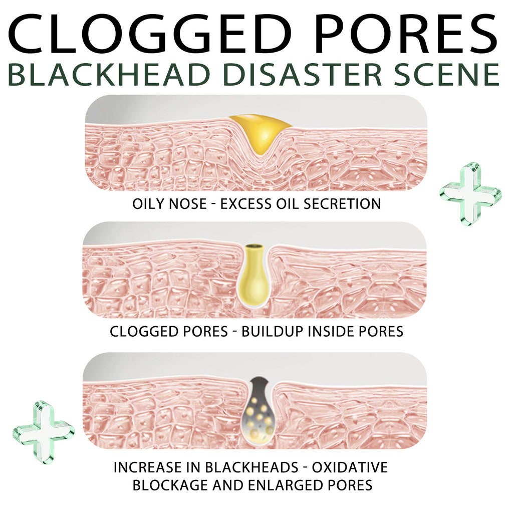Blackhead Remover Peel-Off Mask
