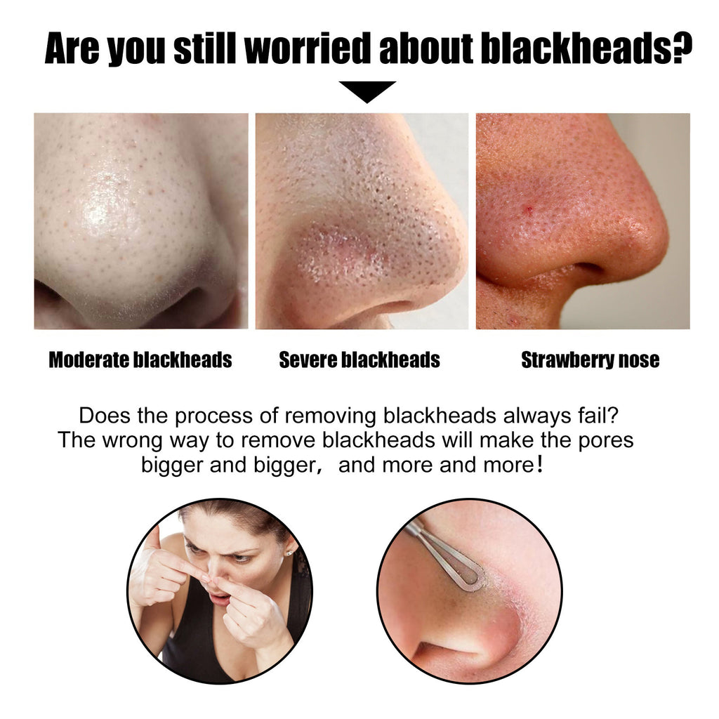 Blackhead Remover Peel-Off Mask